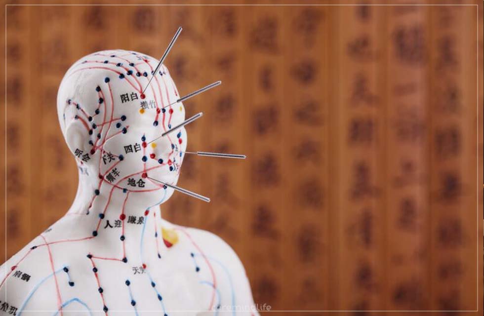 การแพทย์แผนจีน แพทย์ทางเลือก แพทย์แผนโบราณ