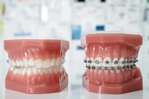 จัดฟันที่ไหนดี