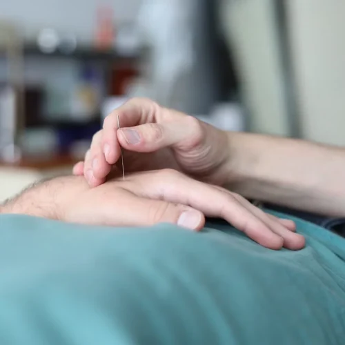 การรักษาโรคเดอกาแวงด้วยการฝังเข็มและการแพทย์แผนจีน