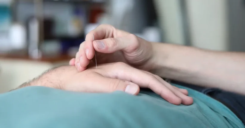 การรักษาโรคเดอกาแวงด้วยการฝังเข็มและการแพทย์แผนจีน